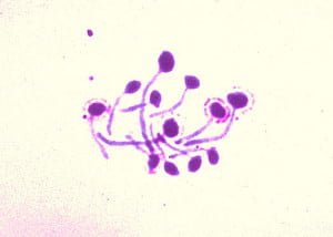 Stained Candida albicans showing germ tube production in serum. By: CDC/ Dr. Lucille K. Georg, Courtesy: Public Health Image Library